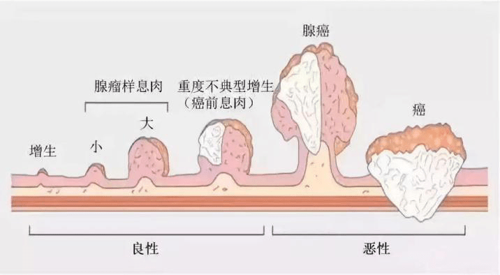 高压力的您，需要一个安全舒适的胃肠镜检查