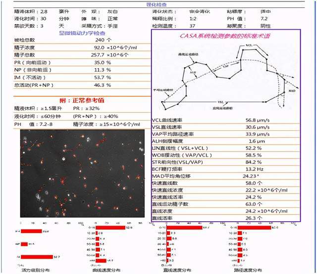 教你如何读懂精液常规分析报告