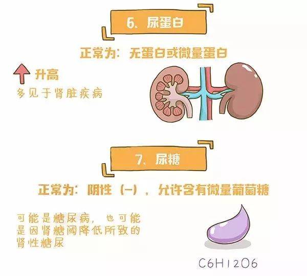 一图读懂尿常规化验单 3分钟学会 快收藏