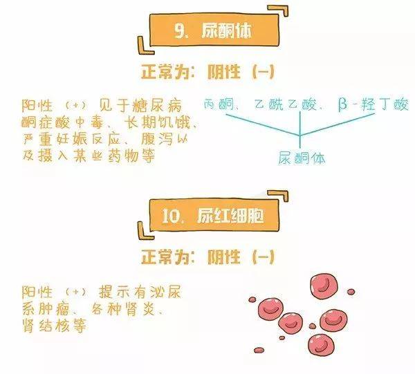 一图读懂尿常规化验单 3分钟学会 快收藏