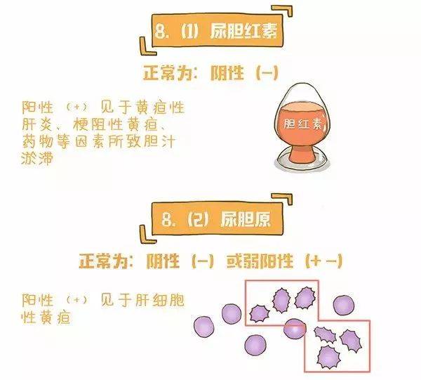 一图读懂尿常规化验单 3分钟学会 快收藏