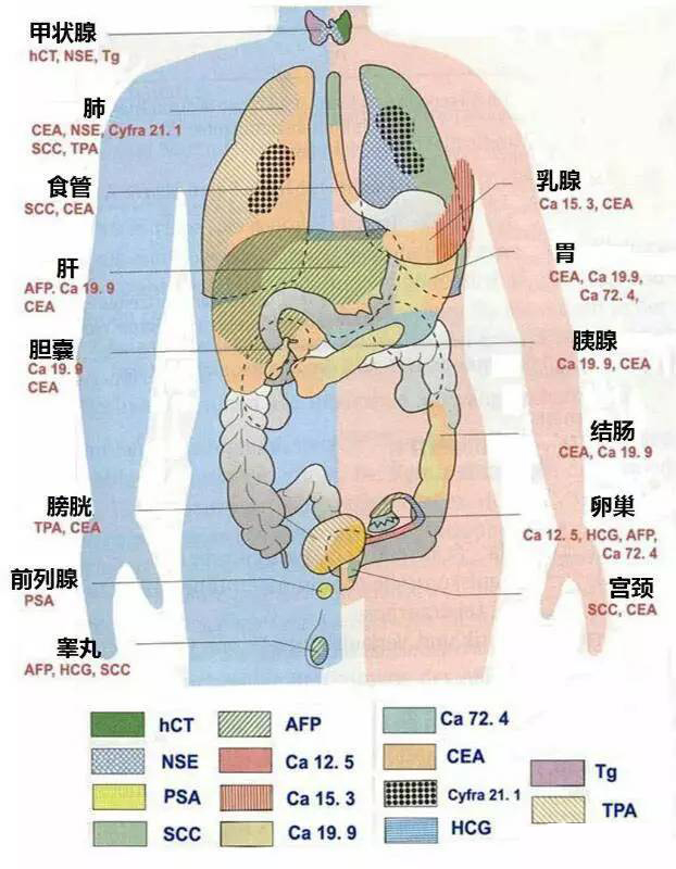 如何正确解读体检报告单中的常见肿瘤标志物？