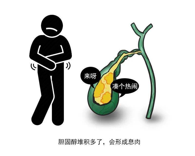 体检发现胆囊息肉怎么办？ 