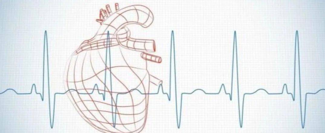 健康体检为什么要让你做“心电图检查”？ 
