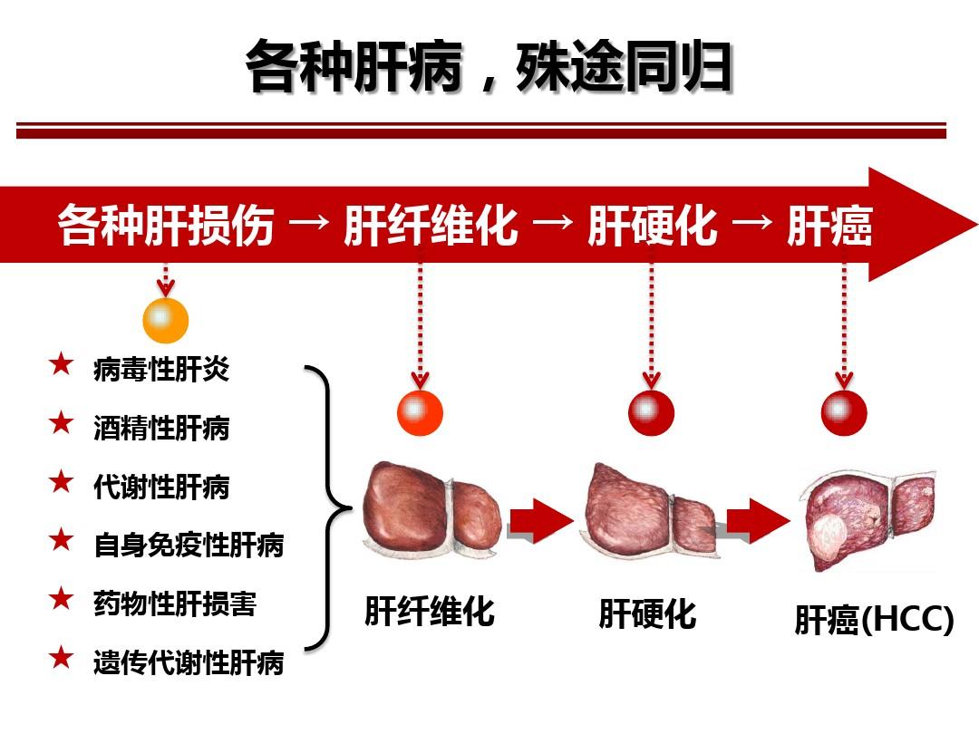 预防肝病做好这几点，避免肝病发展为肝癌