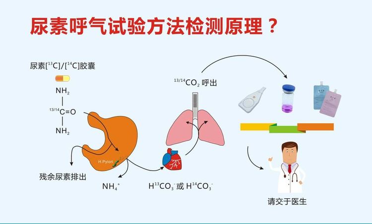 如何检测幽门螺杆菌